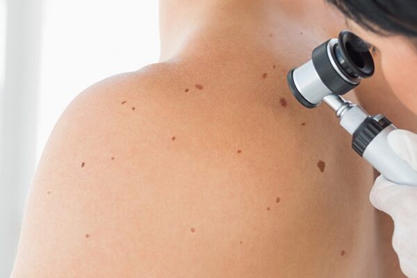 Why You Shouldn't Fear Visiting A Skin Cancer Clinic